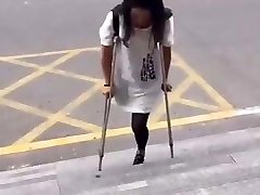 Chinese amputee girl Chinese amputee girl