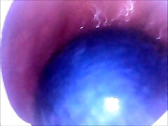 My ass swallows 2 chinese ballsack and 2 pool balls My ass swallows 2 chinese ballsack and 2 pool balls