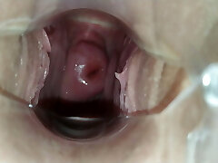 At the GYNECOLOGIST!! A speculum in the dame's pussy!!