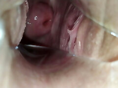 en el ginecólogo!! un espéculo en el coño de la chica!!