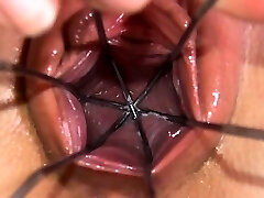 Obgyn gaping of beautiful czech babe Obgyn gaping of beautiful czech babe