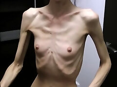 Anorexic Denisa posing and has ribs groped