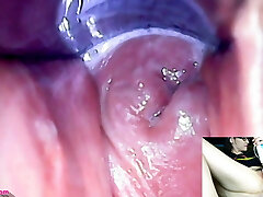 adalynnx - endoscopio speculum hitachi vibratore sperma