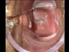 Speculum Cum Speculum Cum