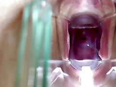 Stella St. Rose - Extreme small malygirl Views and Juices Flowing Using a Speculum