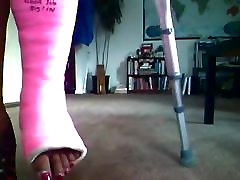 cast aur bachi - broken ankle