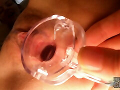 Rebeka Ruby Golf Ball Pussy Stuffing And Opening Up Her Gash With A Gyno Speculum