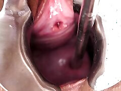 Extreme Cervix Penetration, Sounds, Speculum, Uterus Dilation