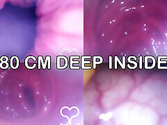 Anal Endoscope all the way in my Transverse Colon - Full Video on Manyvids and Fansly