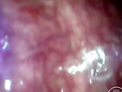 POV Extreme Deep Anal Exploration! Fast Visible Heartbeat