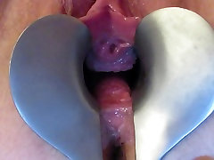 speculum indian home nade open pussy