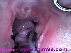 Extreme Anal Fisting, Huge Objects, Cervix milf with an ass, Peehole Fucking, Nettles, Electro Orgasms and Saline Injection