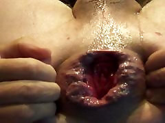 man-cunt gaping prolapse homemade mom son fucking hole stretched asshole