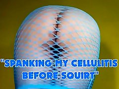Spanking my cellulitis before squirt