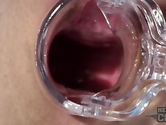 Rebeka Kinky Gyno Exam Cervix And Vaginal Wall Closeups Then Real Orgasm - NebraskaCoeds