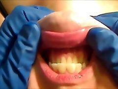 Gloved Mouth Exam