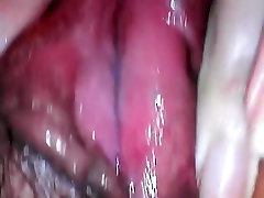 Endoscope trip inside my pee