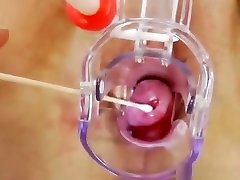 Wife tube porn rosskaya done right plus a medical-tool
