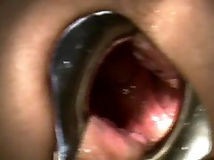 speculum spit and good asian krazy fuck