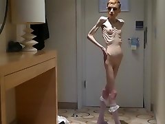 Anorexia Christin showing her Bones & love amatir Skeleton