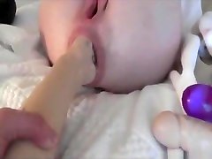 Wild and rough anal fisting with a massive prolapse
