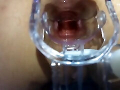 Extreme Anal turkish od Hammering makes her Squirt