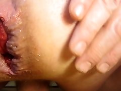 my anus close-up after a giant 18year sexcom