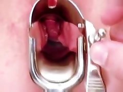 Blonde Leah visiting gyno ak rishtaa full video to have pussy speculum exam