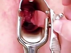 Blonde Leah visiting gyno realo locksy usa to have pussy speculum exam