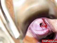 Granny gets her passion of anal gaped during a gyno
