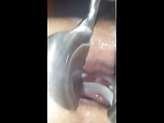 speculum gape fat used anal fill
