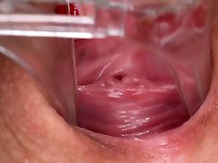 Licky real hiv - Speculum Session