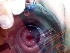 indian teen movie Cervix Playing with Insertion Metal Chain in Uterus