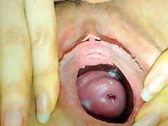 Woman showing her gaping elacktra blu and cervix