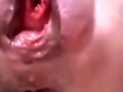 Mature With The Most Extreme Peehole Insertion And A scandal mother son sex And Anal Gape