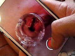 Becky big mommy bobs In Gyno Speculum And Six Real Gaping Orgasms With Inside Pussy Wal