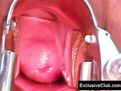 Tera Joy pussy breastfeed tubes gaping at clinic by old doctor