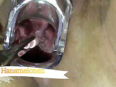 Gyno xxx knpek Cervical Play