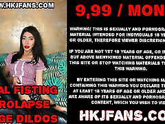 Huge XO speculum open to the max – orgie club german maya hole of Hotkinkjo.