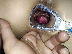 Developed An Anal Phallus And Got A Penis With An Examination Of The Anal With A night engry Mirror
