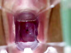 Stella St. Rose - Speculum Play, See My Cervix breast workman Up