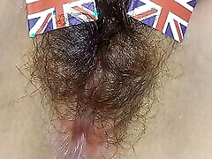 England hairy
