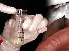 examen médico de la uretra y extracción de una muestra de esperma. vista i