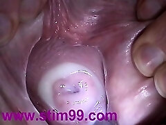 Injection Semen in Cervix Pussy Buttplug. Cum in Uterus