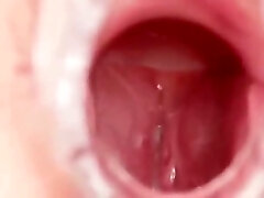 Vaginal Secretion