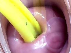 Cervix and Pee Hole Inflation with Injections for Japan Lesb