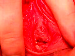 German Teen Girl Uses the Dildo Anal for the First Time