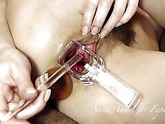 Extreme Pussy Play with Speculum and brrazes hd garls Fuck
