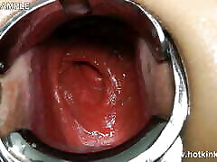 Xo Speculum in Ass and Belly Fuck with Long Dildo by Hotkinkyjo