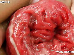 Dig with Fist in the Ass & Anal Prolapse by Hotkinkyjo